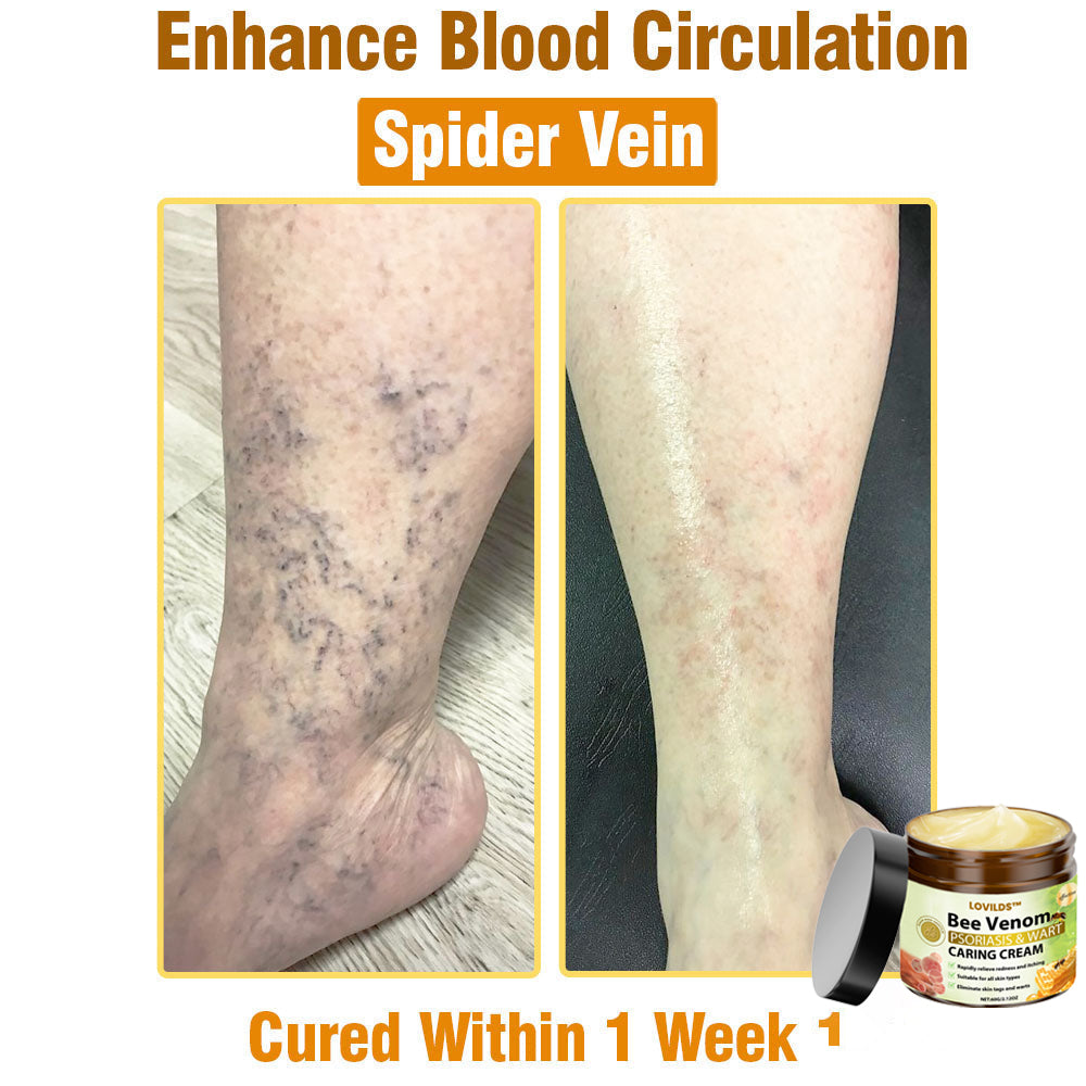 LOVILDS™🐝 Bee Venom All-in-One Cream US Dermatologist Approved🐝