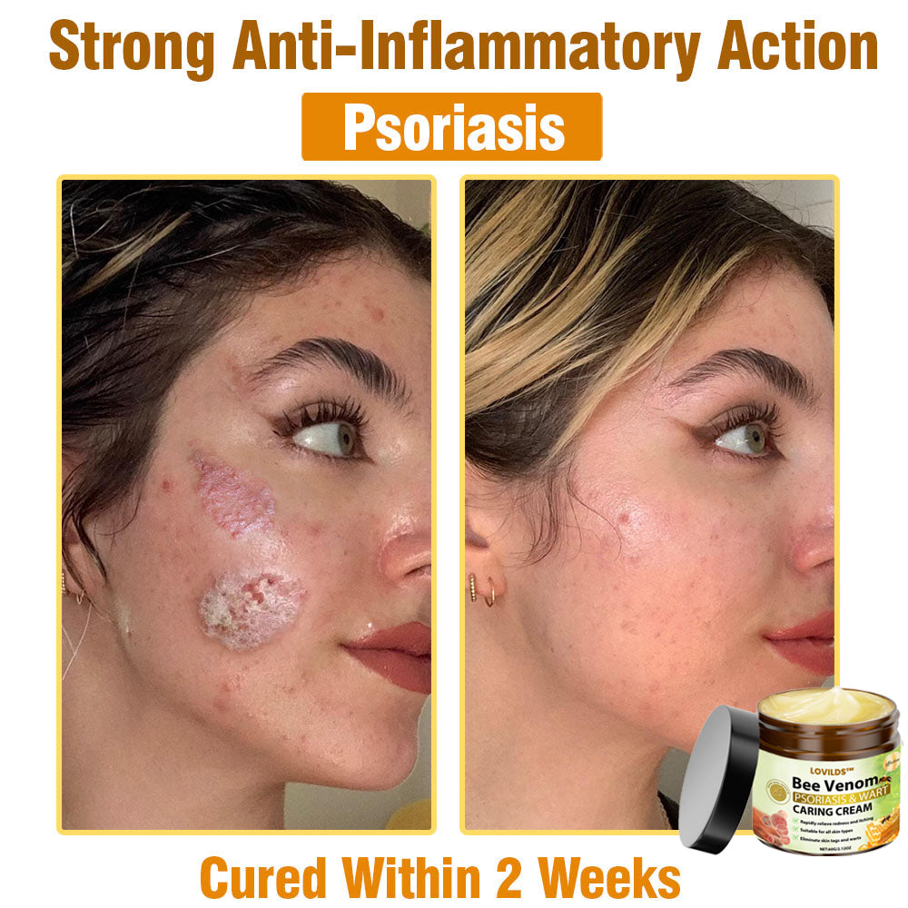 LOVILDS™🐝 Bee Venom All-in-One Cream US Dermatologist Approved🐝