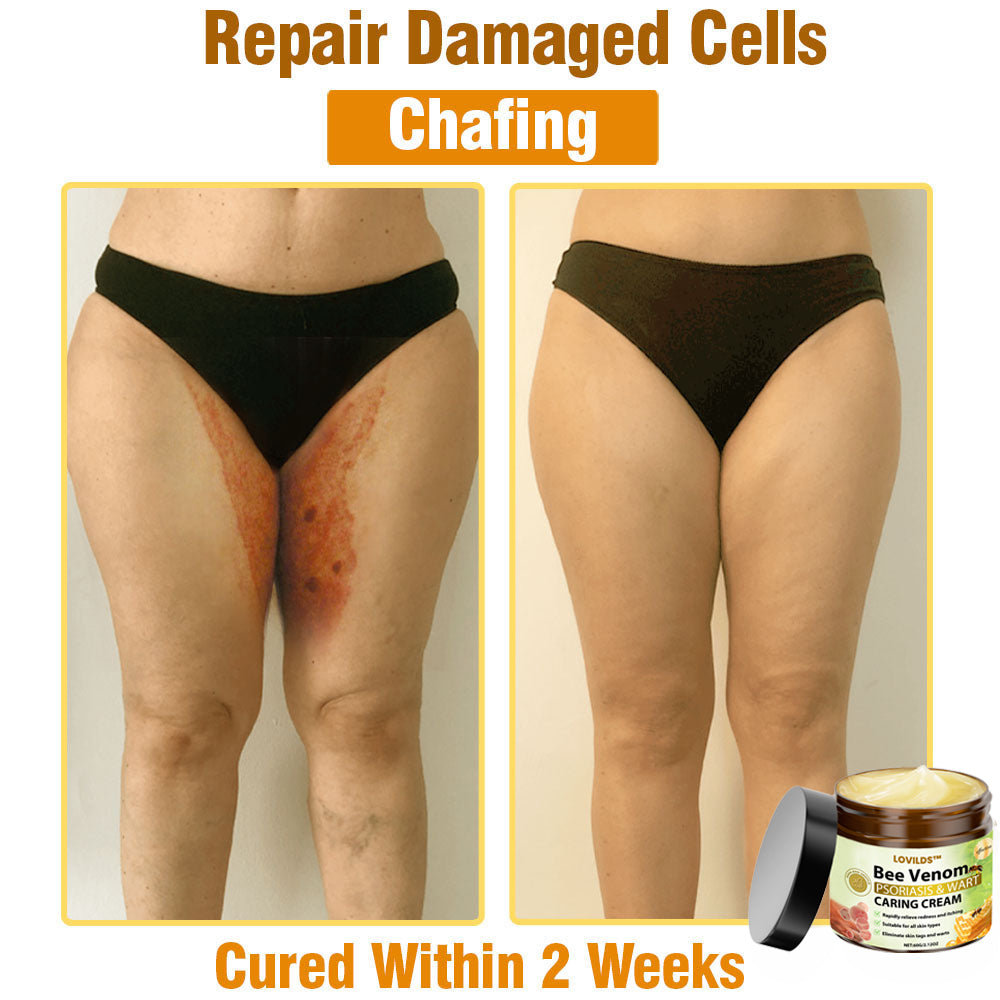 LOVILDS™🐝 Bee Venom All-in-One Cream US Dermatologist Approved🐝