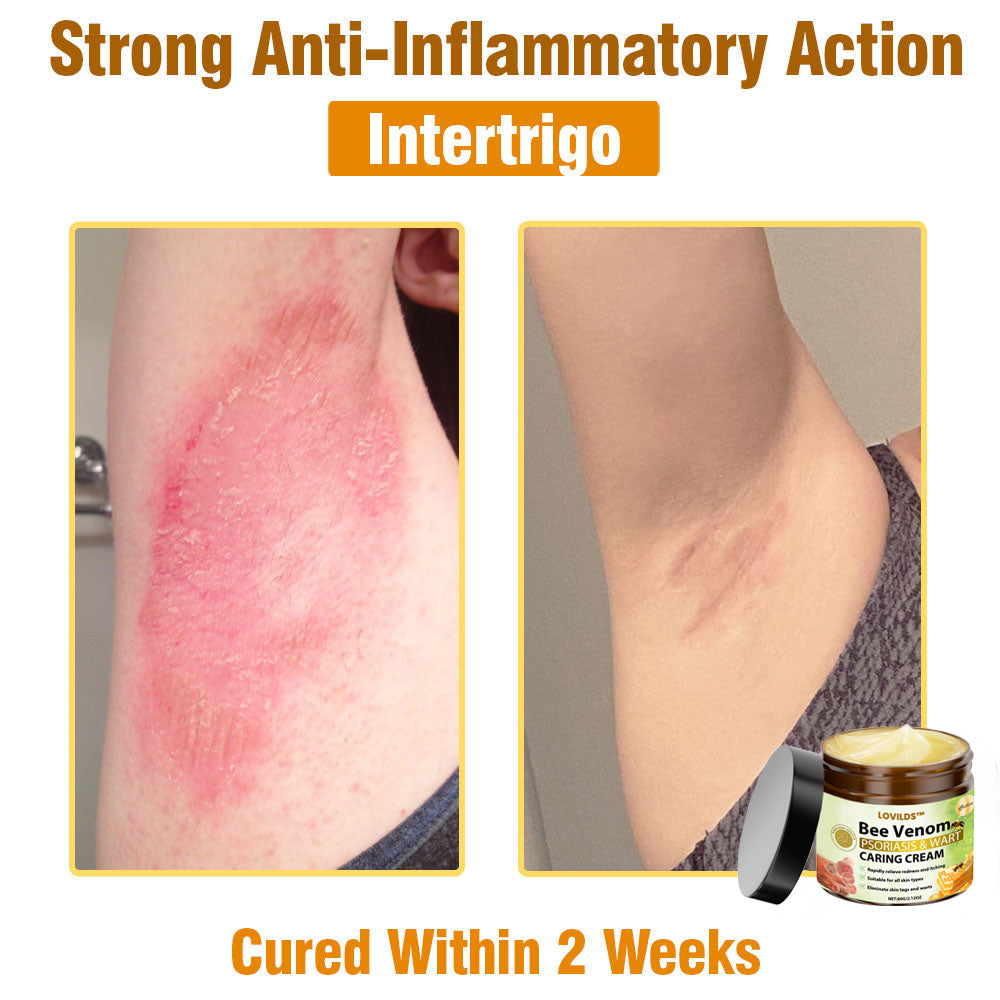 LOVILDS™🐝 Bee Venom All-in-One Cream US Dermatologist Approved🐝