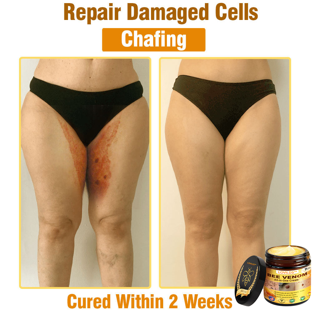 LOVILDS™ Bee Venom All-in-One Cream US Dermatologist Approved🐝🐝