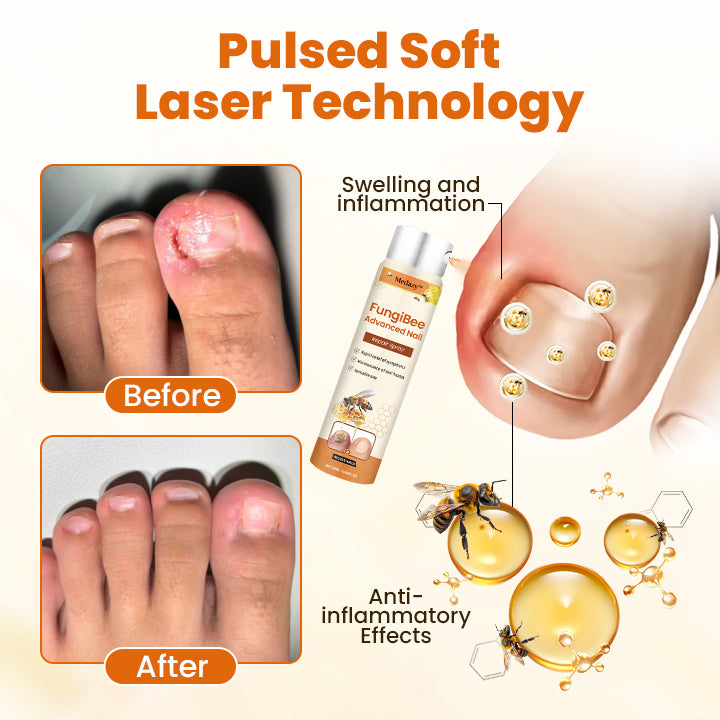 Medazy™ Fungi Bee Advanced Nail Repair Spray