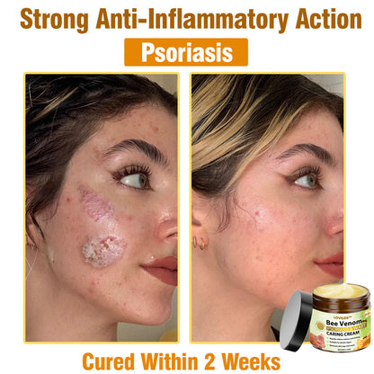 LOVILDS™🐝 Bee Venom All-in-One Cream US Dermatologist Approved🐝