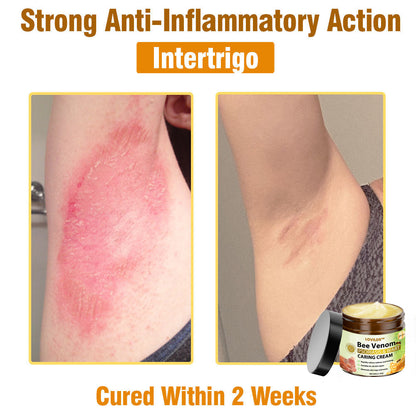 LOVILDS™🐝 Bee Venom All-in-One Cream US Dermatologist Approved🐝