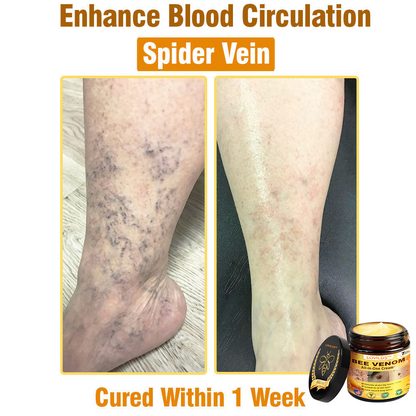 LOVILDS™ Bee Venom All-in-One Cream US Dermatologist Approved🐝🐝