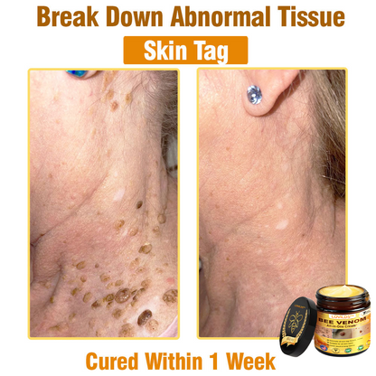LOVILDS™ Bee Venom All-in-One Cream US Dermatologist Approved🐝🐝